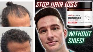 Why RU58841 is in My Hair Loss Protocol 2024