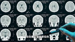 【健康快訊】夏令時結束 專家呼籲注意健康問題 Beware of These Health Problems After Daylight Saving Time Ends