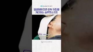세계유일 곡선형 리프팅 #실루엣소프트
