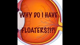 What are Floaters?