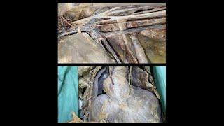 Anatomy of upper limb and thorax (dissection)