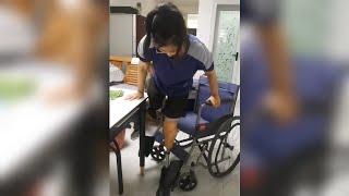 AK BK Hip Amputee Girl Trying a Single Prosthetic Leg | Amputada