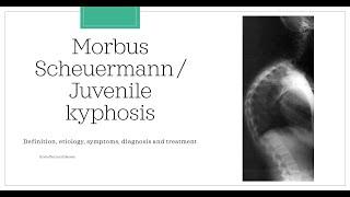 Morbus Scheuermann / Juvenile kyphosis [Essential medicine]