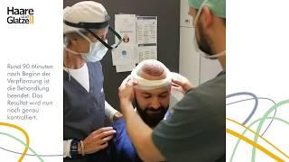 FUE Haartransplantation in 5 Schritten - live dabei