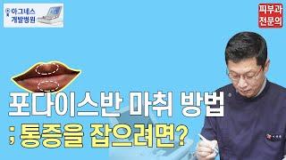 포다이스반점 마취 방법_피부과 제거 통증을 잡으려면?