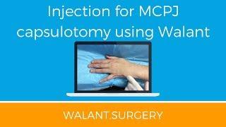 Local anesthesia for MCPJ capsulotomy