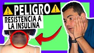 7 SEÑALES   para Identificar [RESISTENCIA a la INSULINA] 