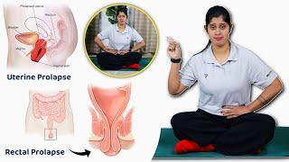 Yoga for Rectal Prolapse and Uterus Prolapse