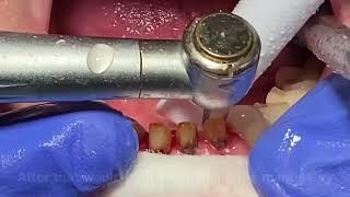 How to make dental crowns