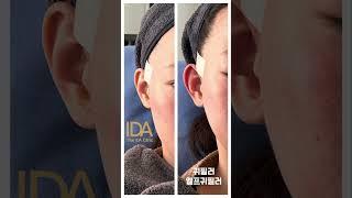 요즘 가장 핫한 필러가 어떤 필러인지 아시나요?
