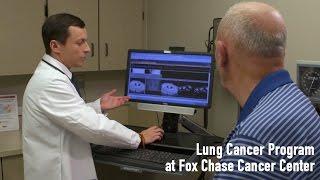 Lung Cancer Program | Fox Chase Cancer Center