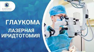 Лазерная иридтотомия иридэктомия при глаукоме - глазная клиника доктора Шиловой