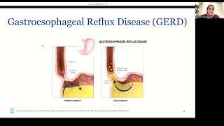 Autism and Gastrointestinal Comorbidities