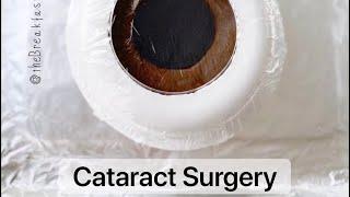 Playdough Surgery  - Cataract Surgery