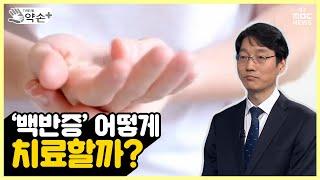 백반증은 어떻게 치료할까?  [피부의 흰색 반점? 백반증 제대로 알기 ⑩] | 메디컬 약손