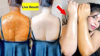 Remove Dark Neck - सिर्फ 1 बार में | How I Remove Darkness From My Body