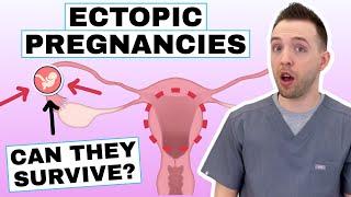 What Is Ectopic Pregnancy? Ectopic Pregnancy Symptoms & Ectopic Pregnancy Risk Factors