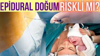 EPİDURAL DOĞUM ( Prenses Doğum ) Avantaj ve Riskleri Nelerdir ? ZARARI Var mı?