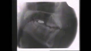 Kevin Munhall Xray Database 2