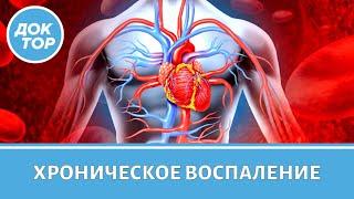 Хроническое воспаление - причины и насколько это опасно?