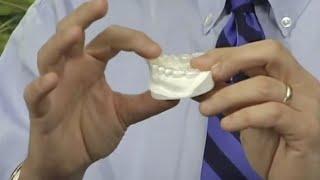 Occlusal Splint Therapy by Dr. Witt Wilkerson