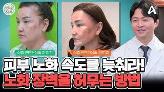 [닥터하우스] 피부 노화를 늦추는 방법 노화 장벽을 허물어야 한다! #항노화 | 행복한 아침 1436 회
