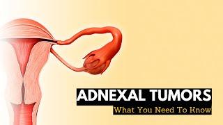 Adnexal Tumors: What You Need To Know