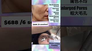 Pico Toning | 皮秒激光 | Define Aesthetic Medical Clinic