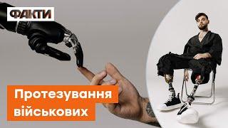  Життя ТРИВАЄ! Як у США проходить процес ПРОТЕЗУВАННЯ українців