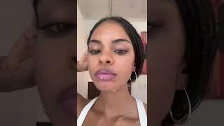 I love it. #chemicalpeel #skincare #skincaretips #acne #acnescars #acnetreatment #scartreatment