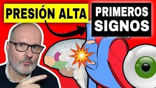 Síntomas INICIALES de PRESIÓN ALTA (Hipertensión arterial)