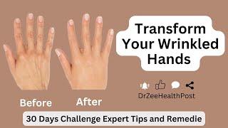 How You Can Transform Your Wrinkled Hands In 30 Days Expert Tips and Remedie