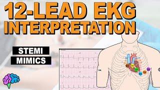 HOW-TO Recognize STEMI Mimics on 12-Lead EKG!