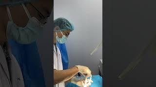 Cắt Bao Quy Đầu Bằng Máy Có Đau Không | Bác Sĩ Sắc Nam Học Bv Việt Đức