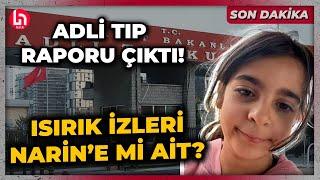 SON DAKİKA! Adli Tıp raporu çıktı! Narin'in ağabeyinin kolundaki ısırık izi kime ait?