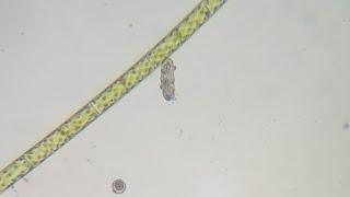 Tardigrades and paramecium