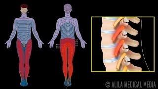 Nerve Root Block Injection Procedure Animation Video