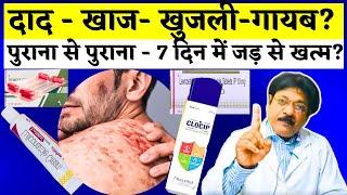 Dad Khaj Khujli Ki Dawa | दाद खाज खुजली जड़ से ख़तम कैसे करे | 4 Best Medicine Dad Khaj Khujli Problem