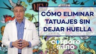 ¿Existe alguna técnica para eliminar tatuajes sin dejar huella?