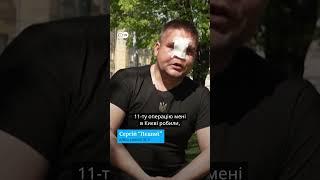 "Поставлять ніс і буду красунчиком" #shorts | DW Ukrainian