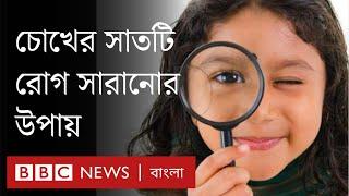 চোখের সাতটি রোগ এবং তা সারিয়ে তোলার উপায়