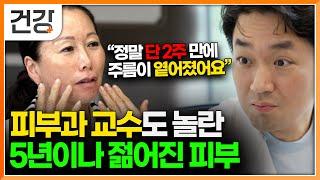 "막을 수 없는 노화! 하지만 젊어질 수 있다면?" 피부과 교수가 말하는 피부 젊어지는 방법 3가지｜귀하신 몸｜#EBS건강