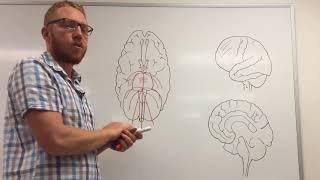 Arterial blood supply of the brain