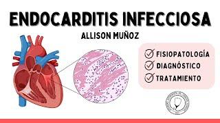 ENDOCARDITIS INFECCIOSA | Cardiología