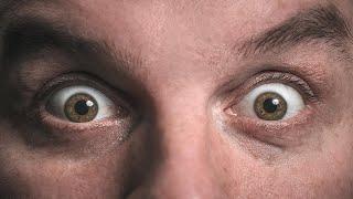 The Resolution of the Human Eye