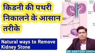 How to Remove Renal Stone?  ( Easy Natural Ways To Get Rid of Kidney Stone)