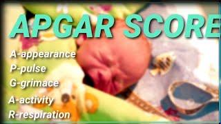 APGAR SCORE//Newborn general health assessment score//बच्चे के जन्म के १ मिनट मे करने वाला स्कोर