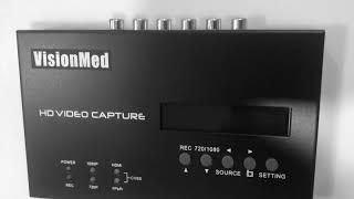 Low cost VisionMed HDMI & Composite video recording system