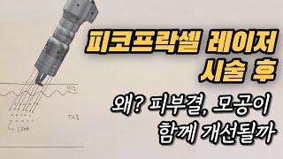 피코프락셀(MLA)과 제네시스를 시술받으면 왜? 색소 뿐 아니라 피부결, 모공이 함께 개선될까요?