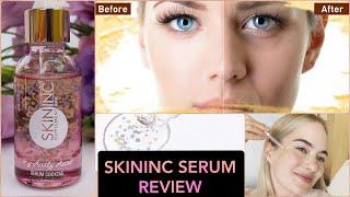 Skininc My Daily Dose of Uplift Serum Review : Beauty skincare review